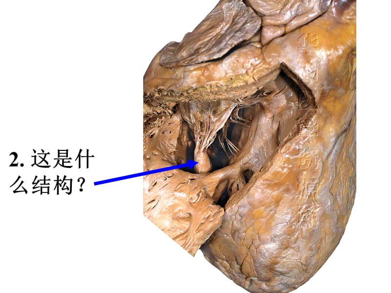 系统解剖标本考试(医学生的必备)免金币.ppt_第3页