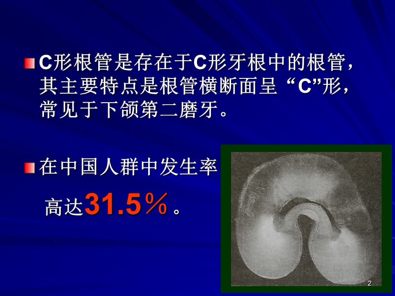 C型根管的形态识别治疗ppt课件_第2页