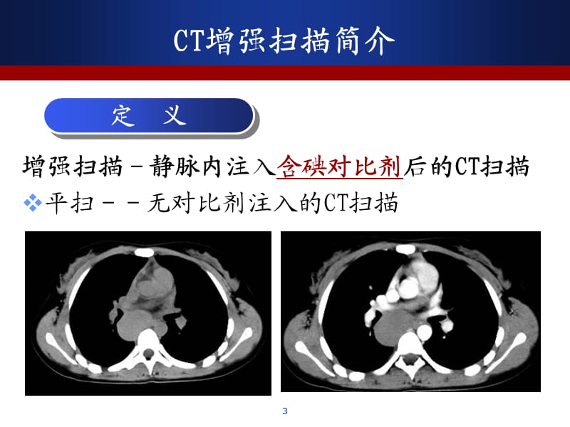 CT增强扫描的临床应用ppt课件_第3页