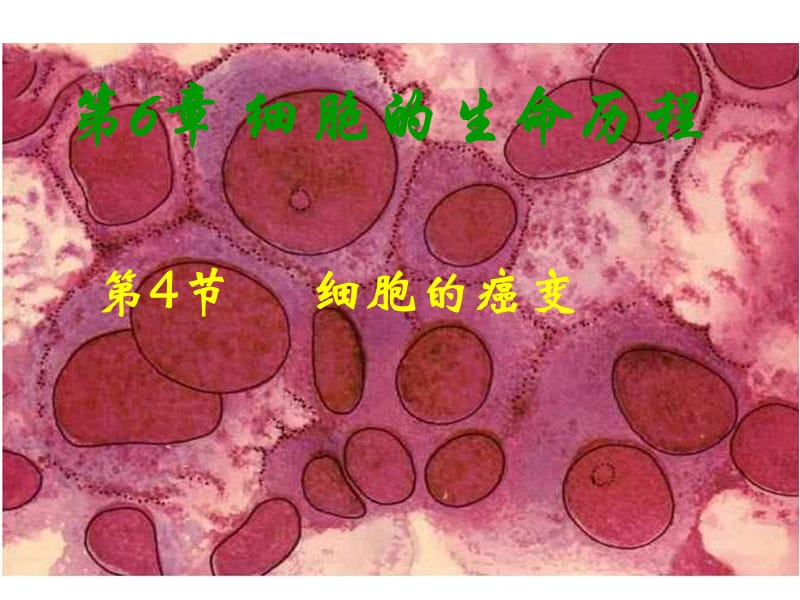 高一生物细胞的癌变.ppt_第1页