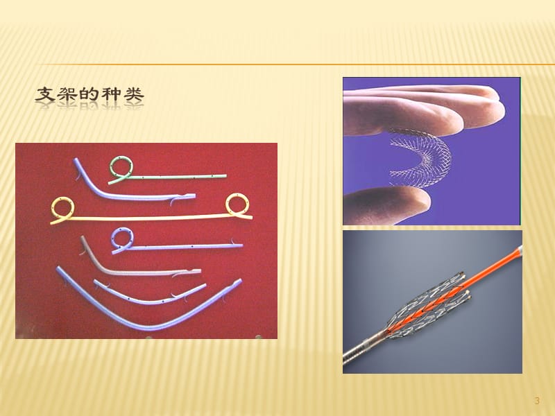 ERCP下胆道胰管支架置入ppt课件_第3页