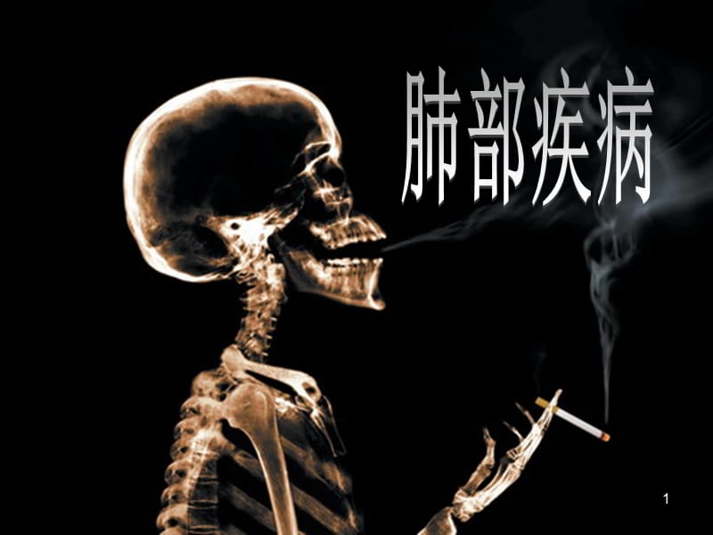 肺部疾病的X诊断ppt课件_第1页