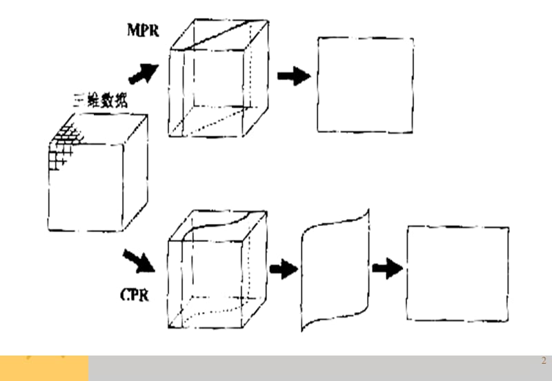 多平面重建ppt课件_第2页