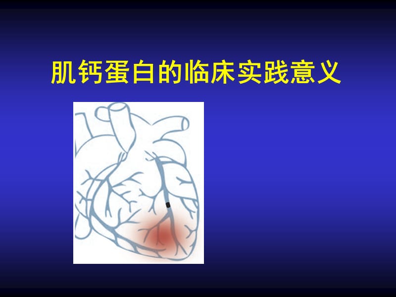 肌鈣蛋白的臨床實(shí)踐意義.ppt_第1頁(yè)