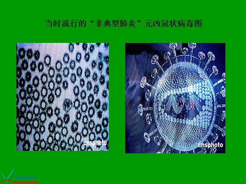 《永远的白衣战士》PPT课件(苏教版四年级语文下册课件).ppt_第3页