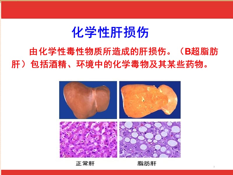 脂甘舒Appt课件_第3页