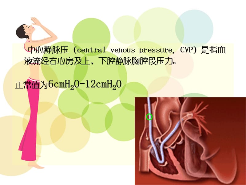 中心静脉压CVP监测ppt课件_第2页