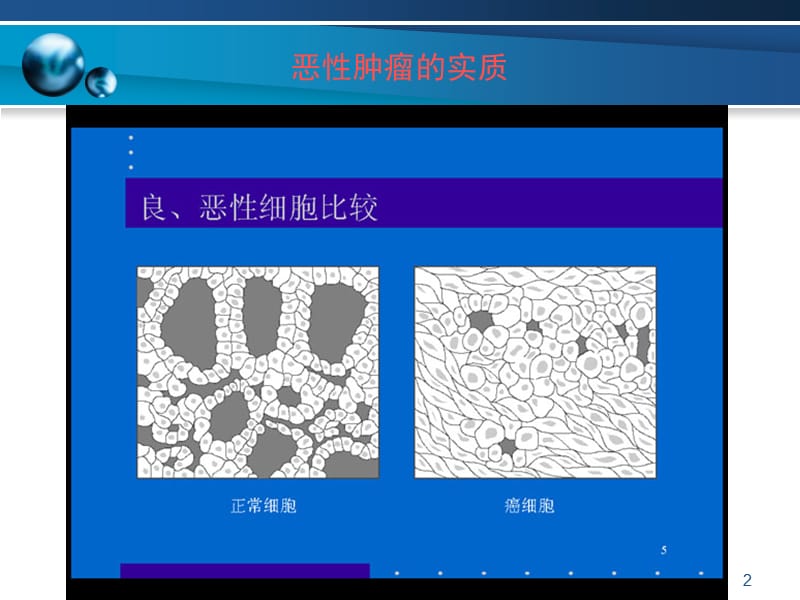 重疾常识之恶性肿瘤ppt课件_第2页