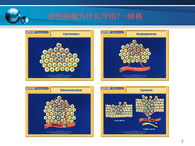 重疾常识之恶性肿瘤ppt课件_第3页