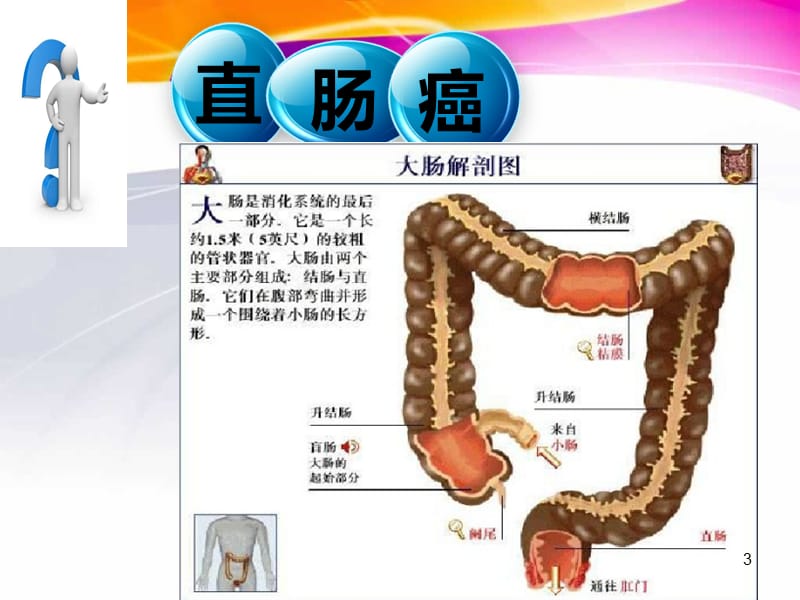 直肠癌的护理查房ppt课件_第3页