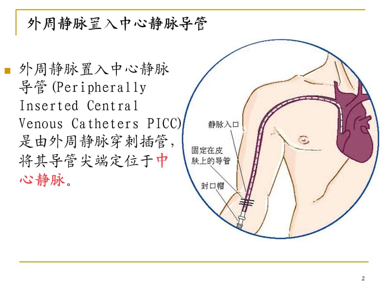 PICC相关静脉的解剖ppt课件_第2页