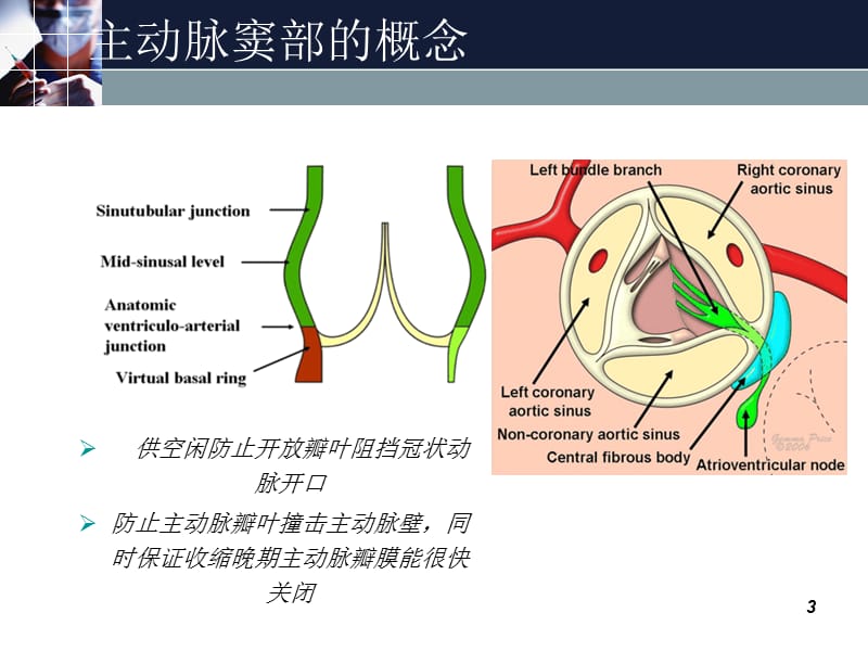 主动脉窦动脉瘤Valsalva窦动脉瘤ppt课件_第3页