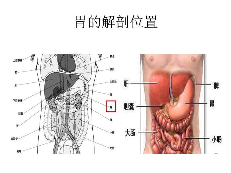 胃癌常见手术方式.ppt_第2页