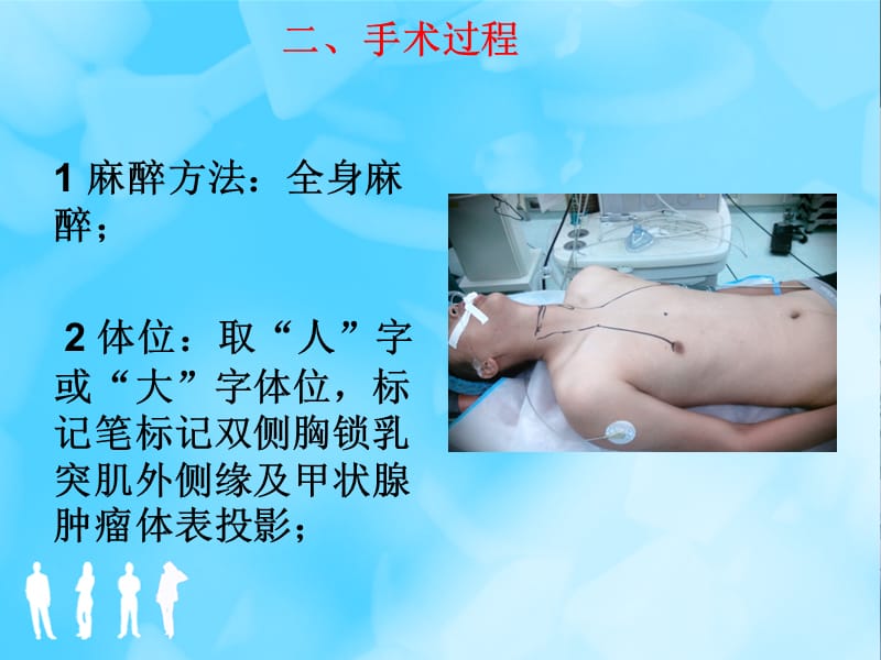 腹腔镜甲状腺切除手术体会.ppt_第3页