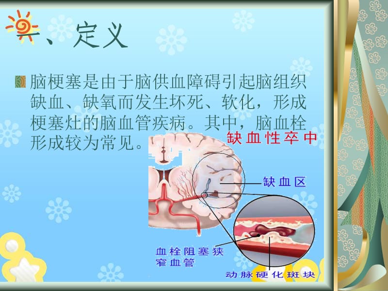 脑梗塞的护理常规.ppt_第2页