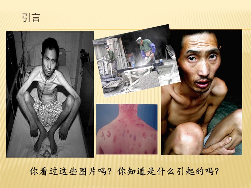 职业卫生专项培训.ppt_第2页