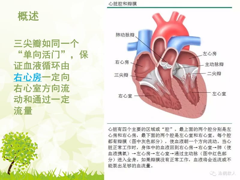 胸腔镜三尖瓣置换术后护理查房.ppt_第3页