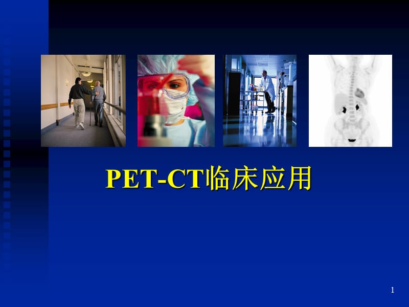 脑部PET的临床应用.ppt_第1页