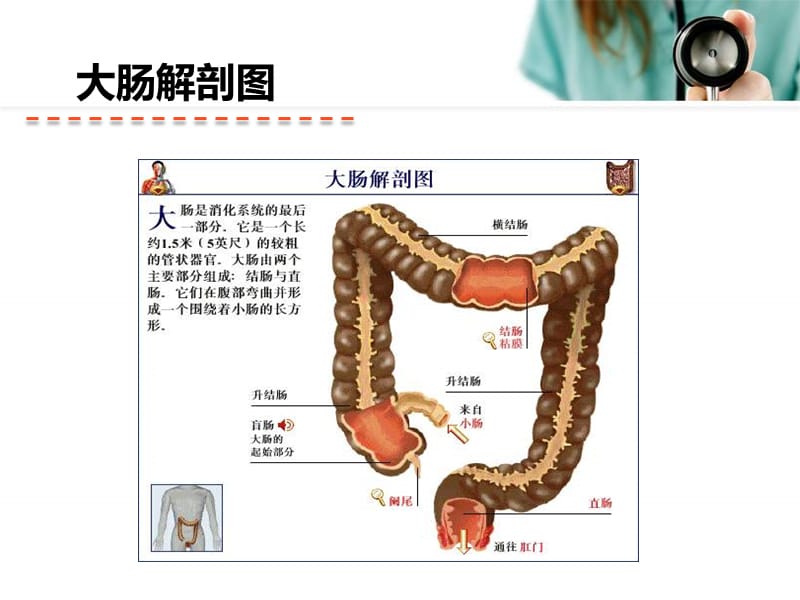 直肠癌根治术术后护理.ppt_第3页