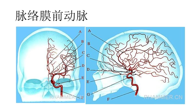 脑动脉解剖及临床(脉络膜前动脉).ppt_第2页