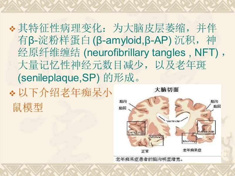 老年痴呆动物模型.ppt_第3页