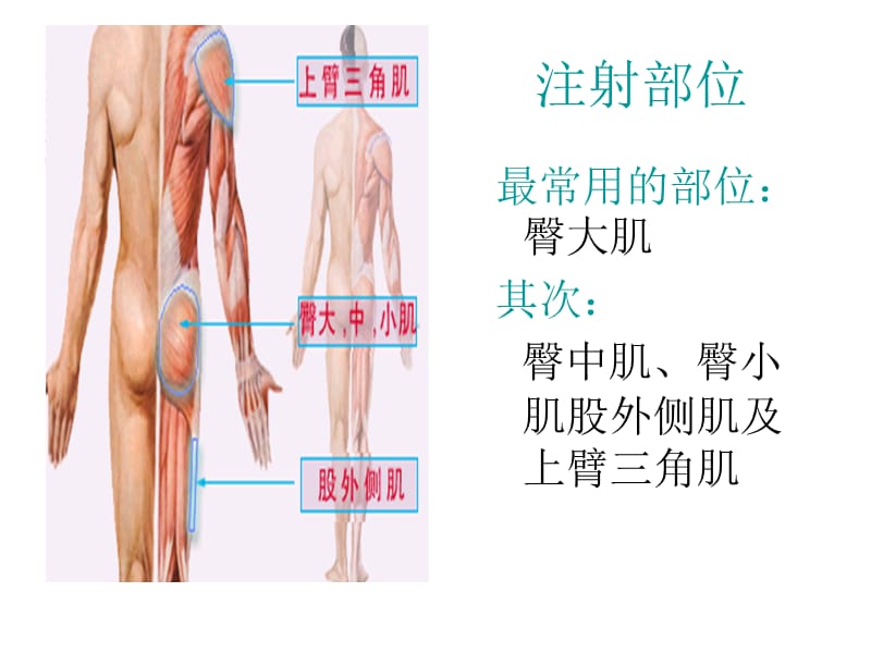 肌肉注射-PPT(精).ppt_第3页