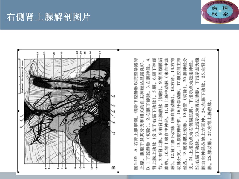 肾上腺的解剖与功能.ppt_第3页