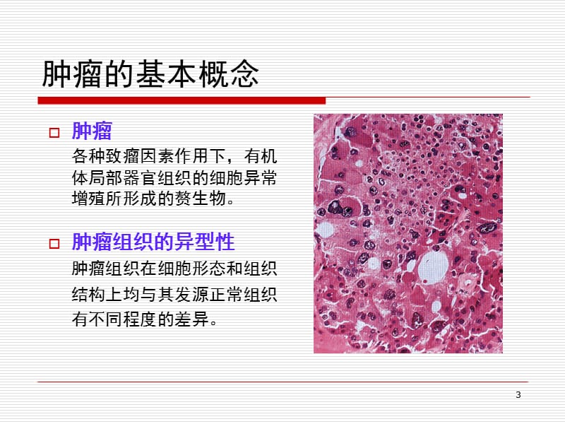 肿瘤学基础ppt课件_第3页