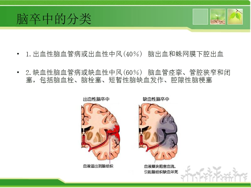 脑卒中防治知识讲座.ppt_第3页