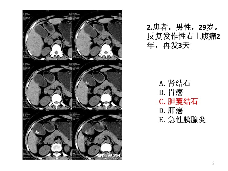 住院医师规陪出科考试辅助检查1ppt课件_第2页