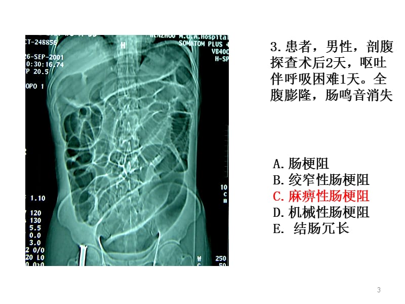 住院医师规陪出科考试辅助检查1ppt课件_第3页