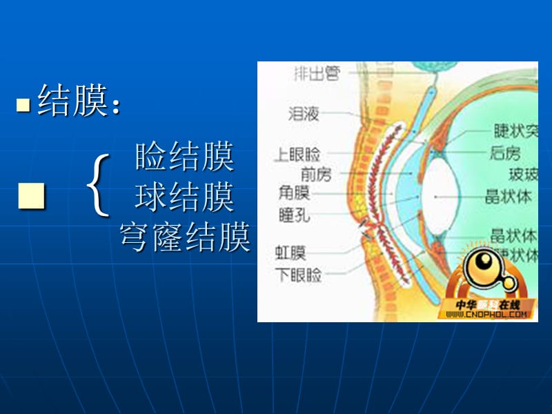 结膜病本科班课件.ppt_第3页