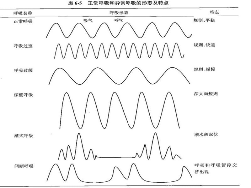 脑损伤后的呼吸形式改变及意义.ppt_第3页