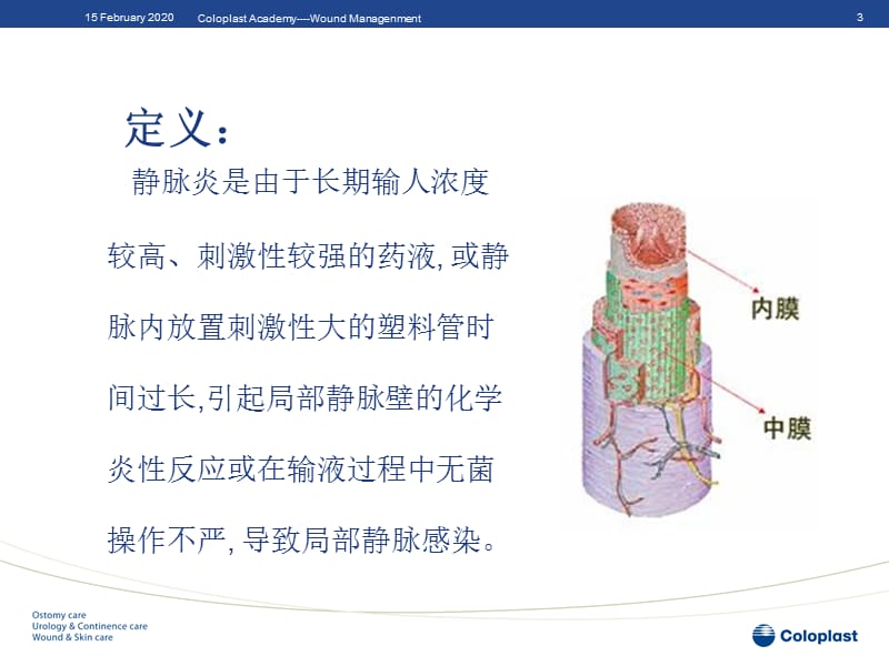 静脉炎的分类与处理.ppt_第3页