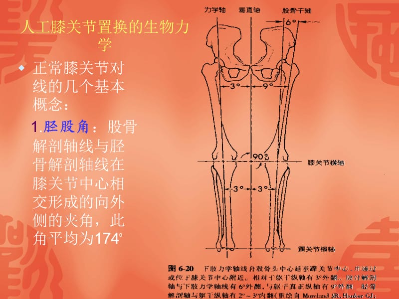 膝关节表面置换术.ppt_第3页