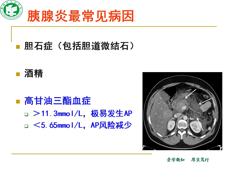 血浆置换治疗高脂血症性重症急性胰腺炎.ppt_第3页