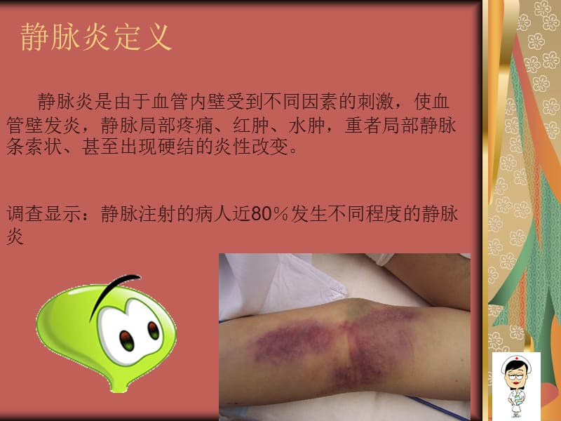 静脉炎的预防与护理.ppt_第3页