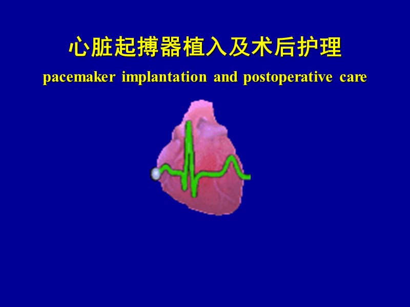 起搏器植入及术后护理.ppt_第1页