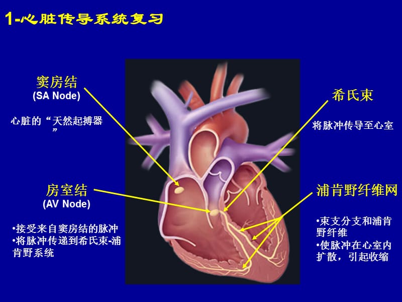 起搏器植入及术后护理.ppt_第3页