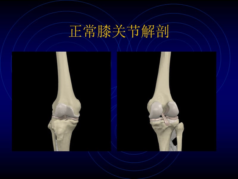 膝关节损伤常用检查法.ppt_第3页