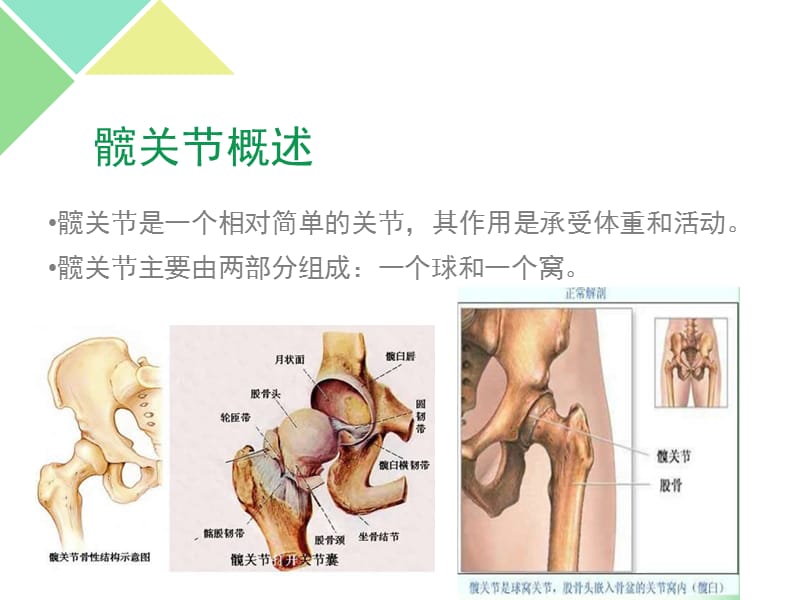 髋关节置换术后护理课件.ppt_第2页