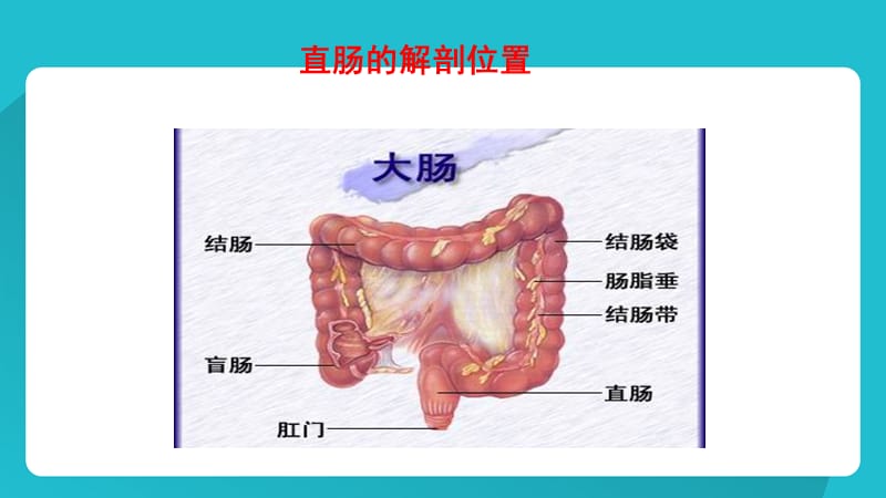 直肠癌护理业务学习_第3页