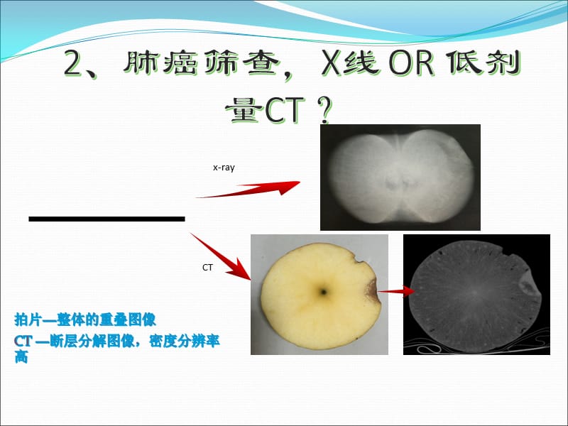 早期肺癌低剂量CT筛查_第3页