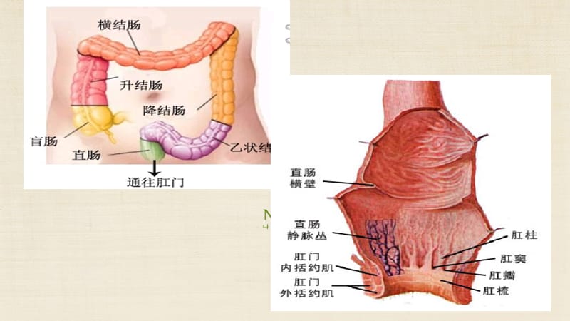 直肠癌手术护理_第3页