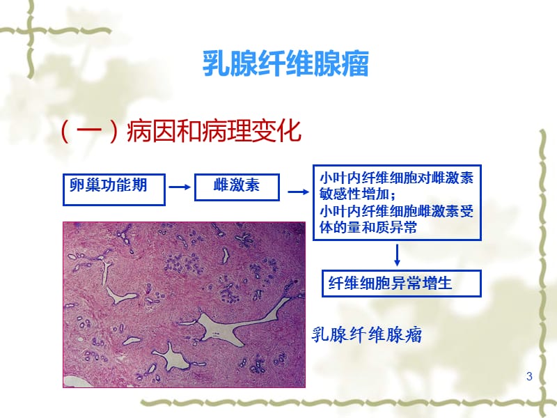 常见乳腺肿瘤的影像表现ppt课件_第3页