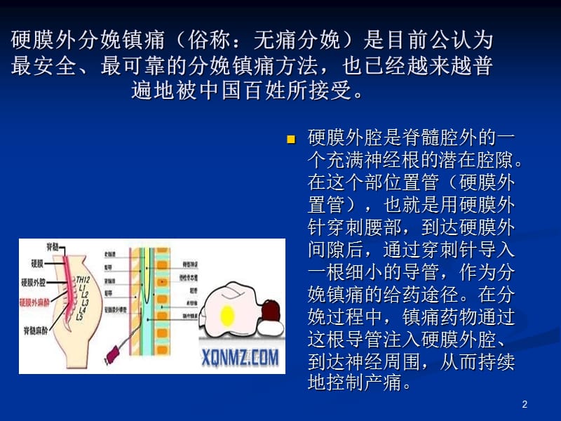 产后腰痛ppt课件_第2页