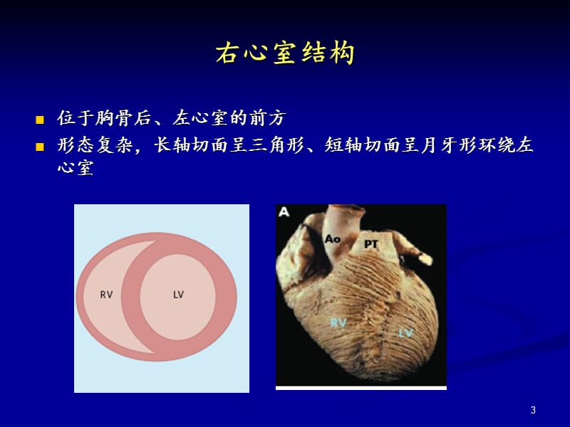 超声心动图评价右心功能ppt课件_第3页