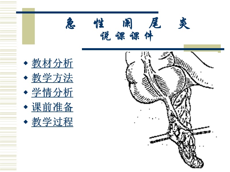 急性阑尾炎说课课件.ppt_第2页