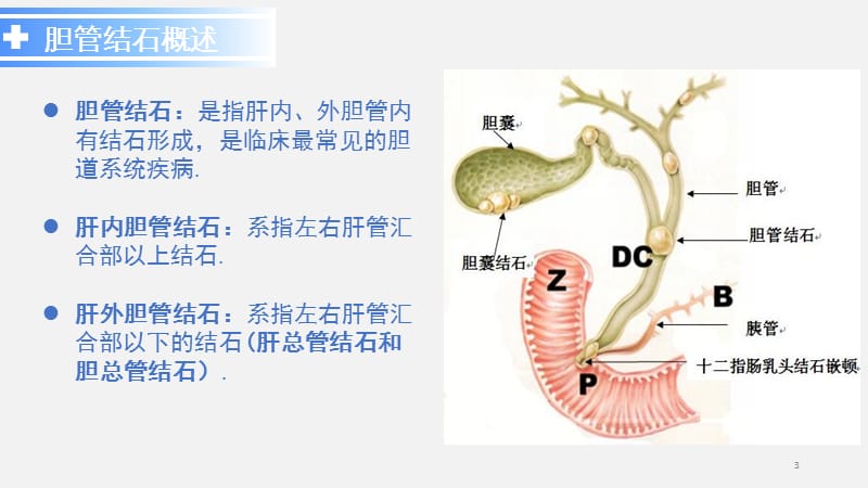 胆管结石ppt课件_第3页