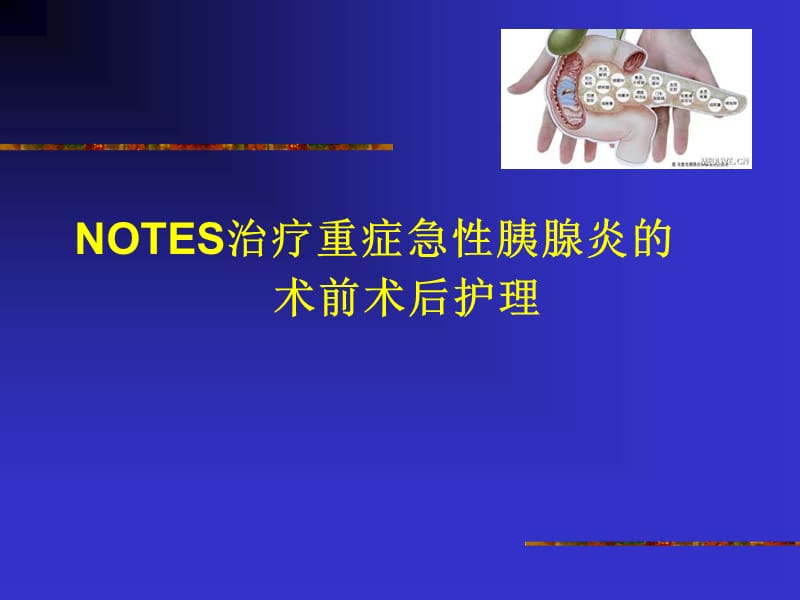 NOTES治疗重症胰腺炎PPT医学课件_第1页